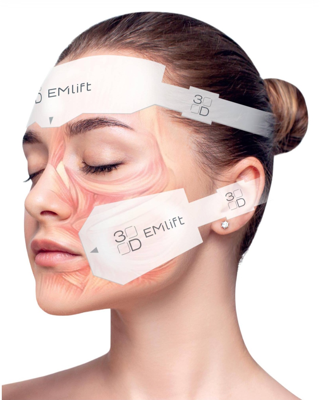 3D EMlift applicators on the face